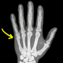 Hand Skeleton GIF - Hand Skeleton Joint GIFs