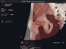 Inferior Gemellus Hip Abduction GIF