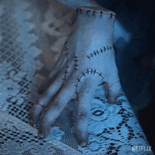 a hand with stitches on it is on a table with a netflix logo visible