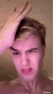 a young man is making a funny face while holding his hand to his forehead .
