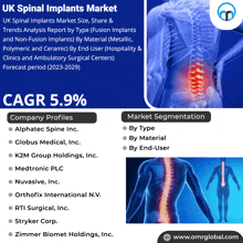 Uk Spinal Implants Market GIF - Uk Spinal Implants Market GIFs