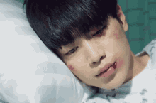 서강준 다침 부상 슬픔 슬픈 입원 병원 환자 환자복 치즈인더트랩 GIF - Seo Kangjoon Injured Sad GIFs