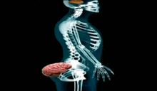 an x-ray of a person 's skeleton with a brain visible