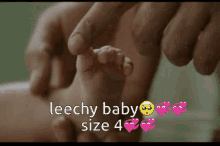 leech baby