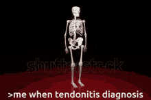 Skeleton Tendonitis GIF - Skeleton Tendonitis Tendinitis GIFs