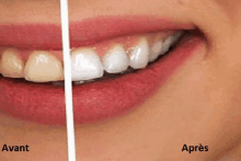 Smile Dentiste GIF - Smile Dentiste GIFs