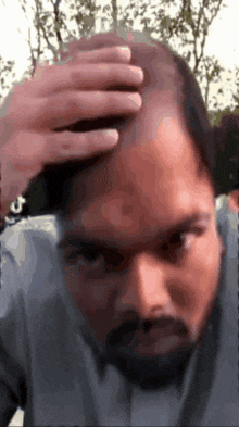 a man with a beard is holding his head with his hands
