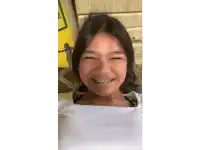 a young girl with braces on her teeth smiles for the camera