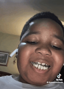 a young boy with braces on his teeth is smiling for the camera and has a tiktok account