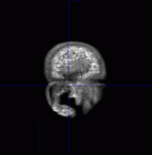 a black and white image of a person 's brain with a blue line around it