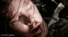 a person with blood on their face is laying on the ground .