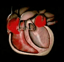 Sinusrhythm Heartbeats GIF - Sinusrhythm Heartbeats GIFs