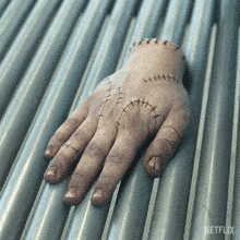 a hand with stitches on it is on a metal surface with a netflix logo