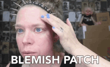 Blemish Patch Imperfection GIF - Blemish Patch Imperfection Scar GIFs