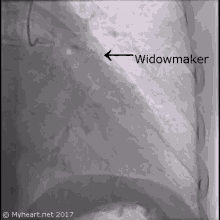Widow Maker GIF - Widow Maker Heart GIFs