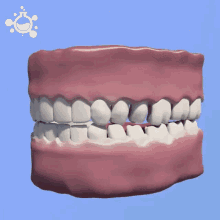 Gum Disease Teeth Chatter GIF