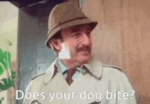 a man wearing a hat and trench coat says " does your dog bite ? "