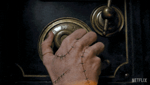 a hand with stitches on it is using a combination lock