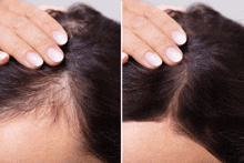 Hair Loss Woman GIF - Hair Loss Woman GIFs