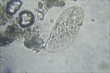 Diatoms GIF