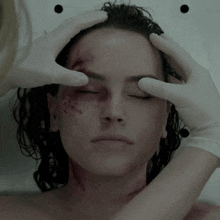 a woman with a black eye is being examined by someone wearing gloves