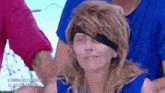 a woman with a bandage on her eye is sitting in front of a man in a blue shirt .