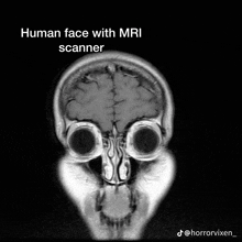 a black and white image of a human face with the words human face with mri scanner
