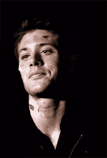 Bruised Dean Winchester GIF - Bruised Dean Winchester Jensen Ackles GIFs
