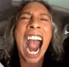 a man with braces on his teeth is making a funny face with his mouth open .