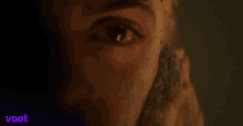 Dry Skin Asur Welcome To Your Dark Side GIF - Dry Skin Asur Welcome To Your Dark Side My Skin Is So Dry GIFs