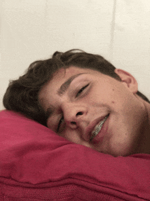 a young man with braces on his teeth laying on a pink pillow