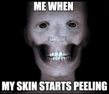 a scary face with the words me when my skin starts peeling on it