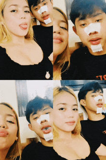 a collage of photos of a man and a woman with bandages on their noses