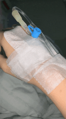 a person with a needle in their hand