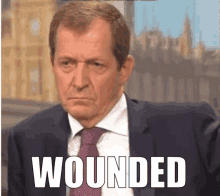Alastaircampbell Wounded GIF - Alastaircampbell Alastair Campbell GIFs