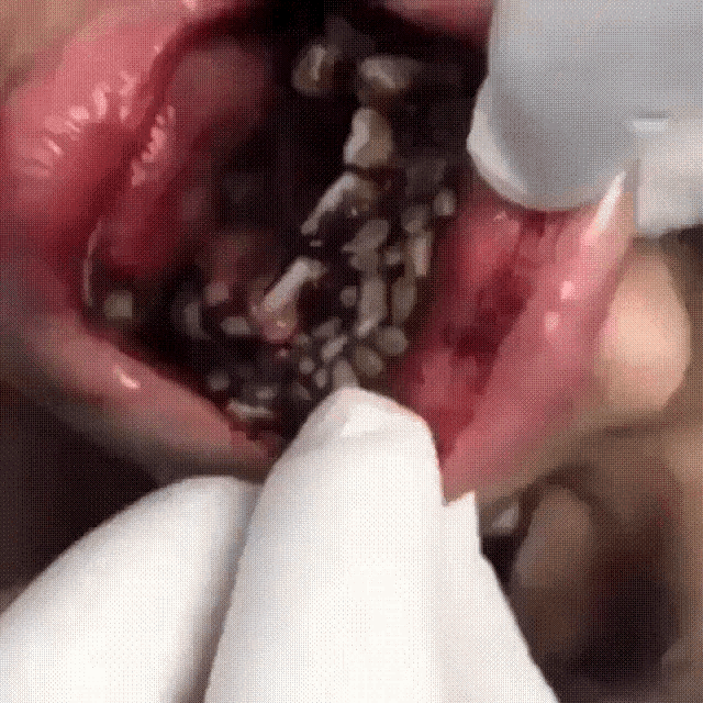 Maggots Mouth GIF - Maggots Mouth Teeth - Discover & Share GIFs