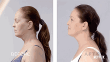 Before And After Skin Decision GIF