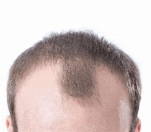 Hairline Check GIF - Hairline Check GIFs