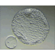Hatched Blastocyst GIF - Hatched Blastocyst GIFs
