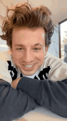 a young man with a bandage on his face is smiling while laying on a table .