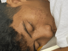 a close up of a person 's face with a white shirt on