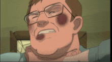 a cartoon of a man with glasses and a black eye