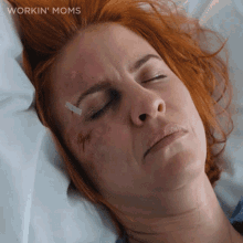 a woman with a bandage on her forehead is laying on a bed