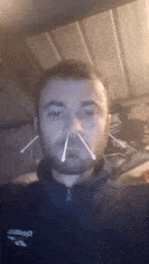 a man with a beard is taking a picture of himself with cotton swabs in his nose .