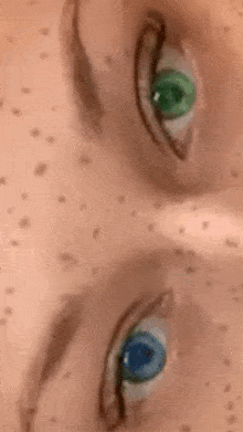 a close up of a person 's eyes with blue and green eyes and freckles .
