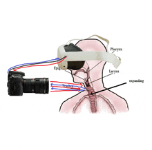 a diagram of a person 's larynx with a camera attached to it