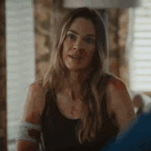 a woman with a bandage on her arm is sitting in a room .