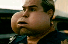 a close up of a man 's face with a large bump on it