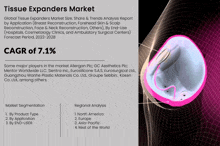 Tissue Expanders Market GIF