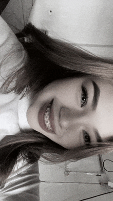 a girl with braces on her teeth is smiling for the camera